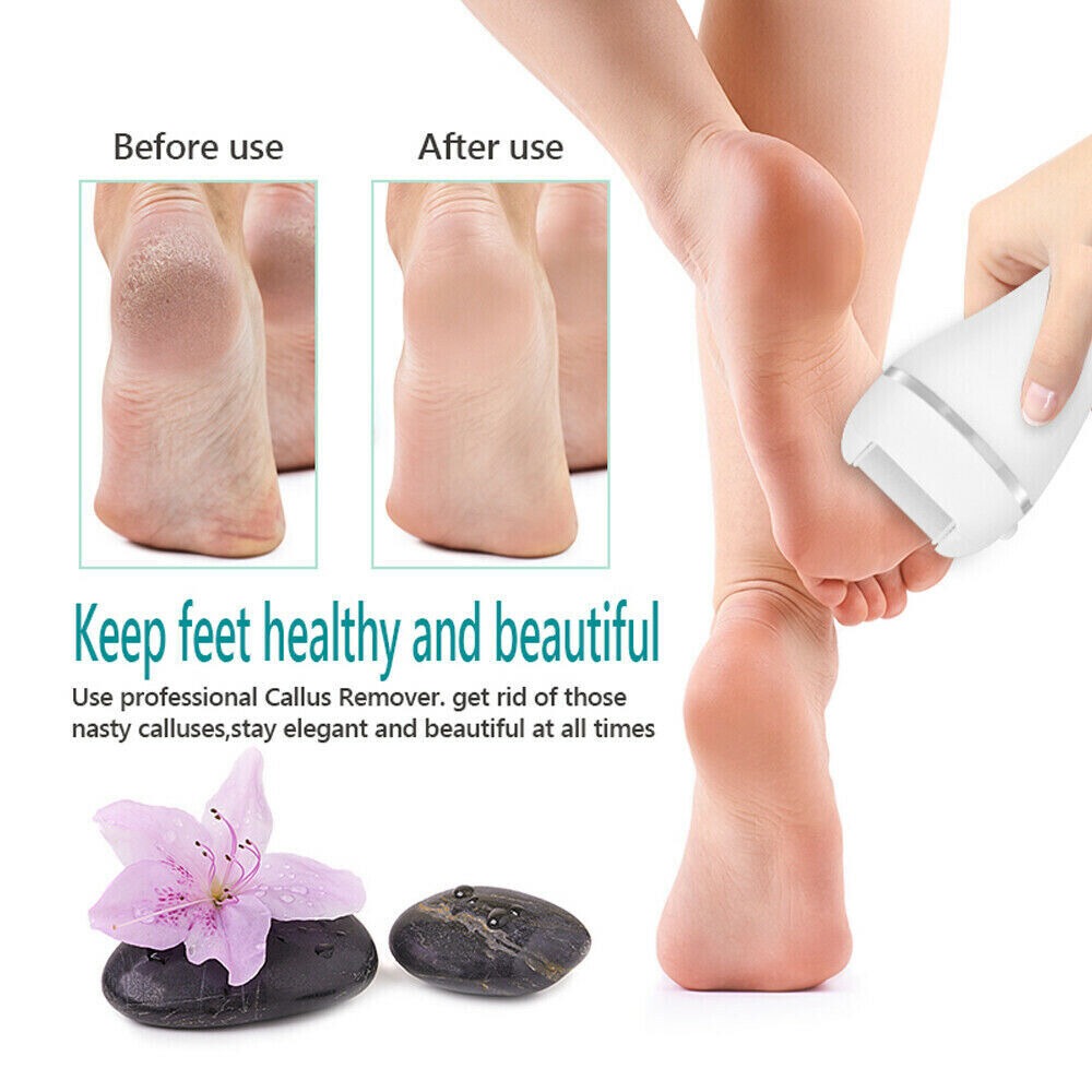 Electric USB Callus Foot File Remover Hard Skin Pedicure Rechargeable Tool - SMH345