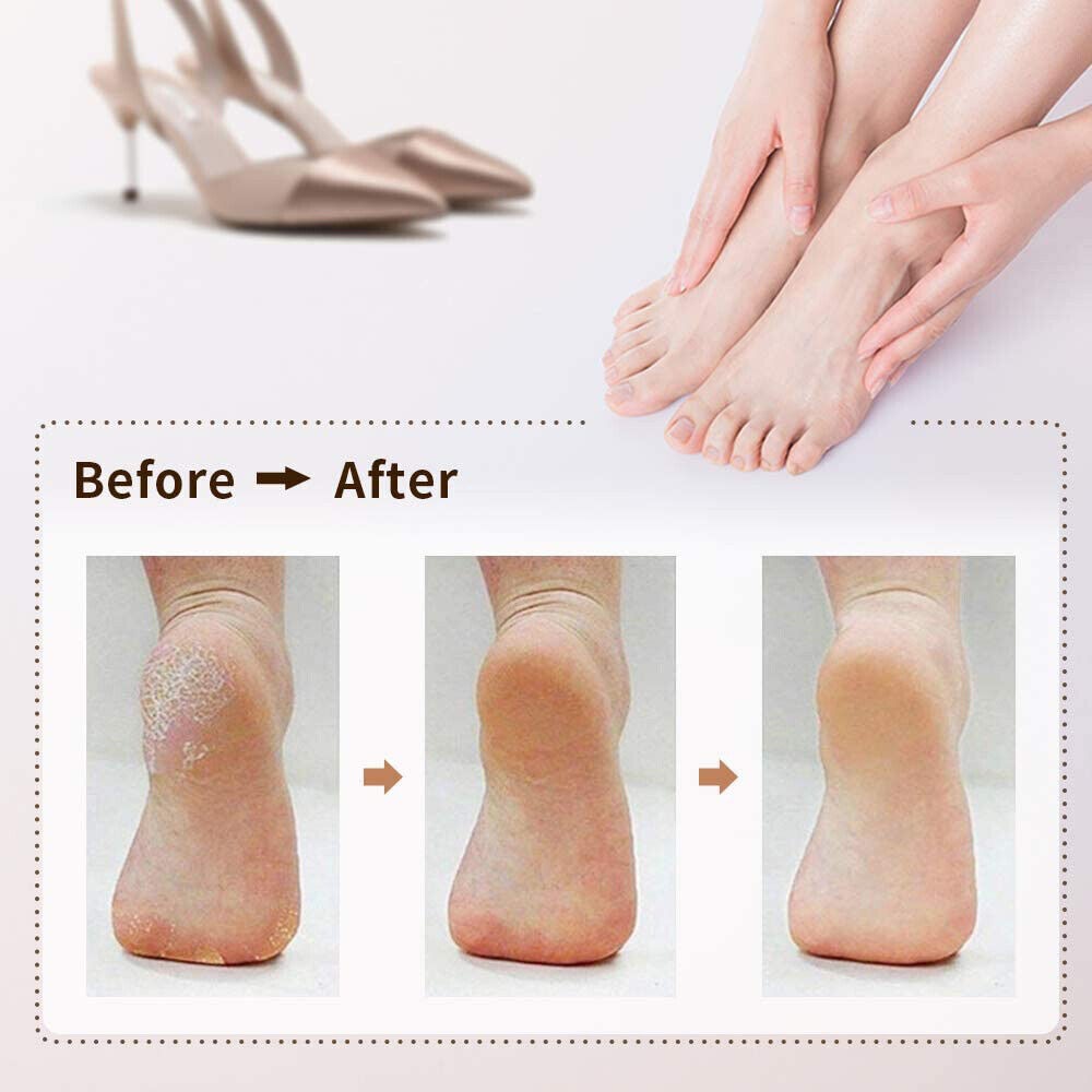 Electric USB Callus Foot File Remover Hard Skin Pedicure Rechargeable Tool - SMH345