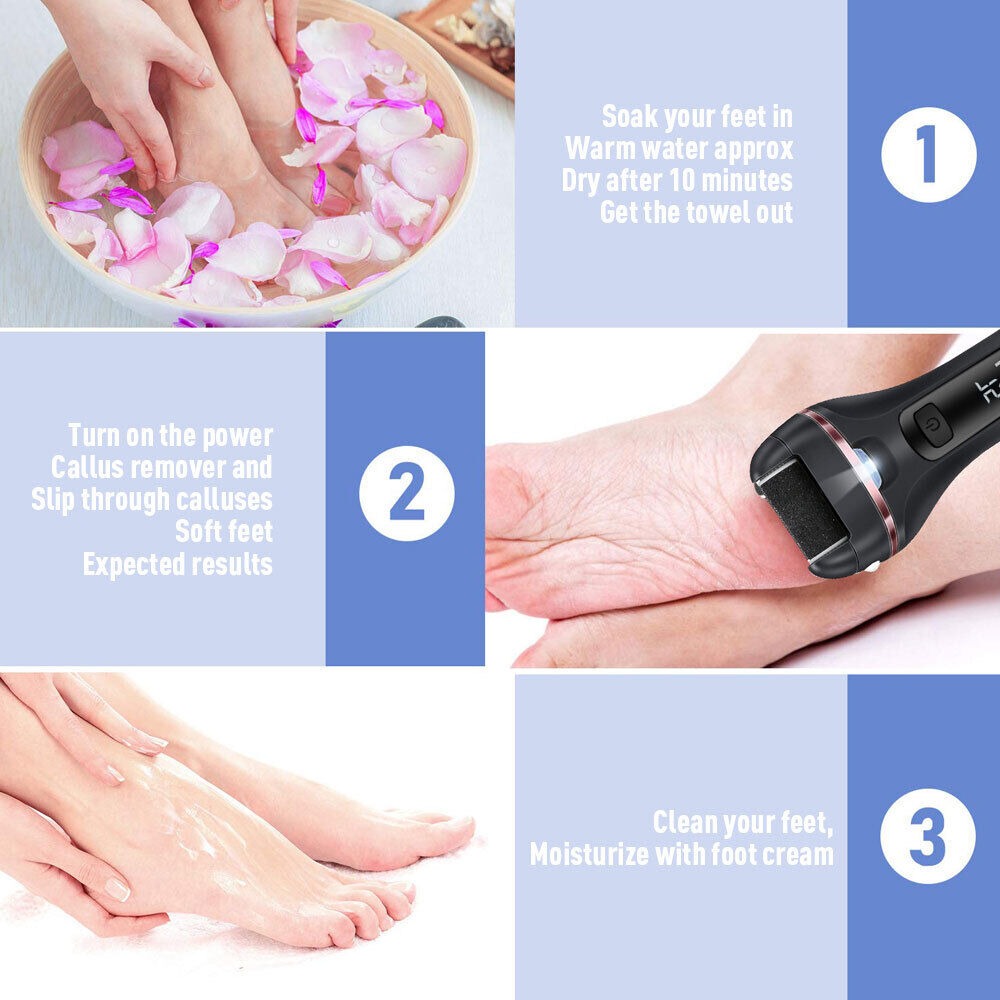 Electric USB Callus Foot File Remover Hard Skin Pedicure Rechargeable Tool - SMH345